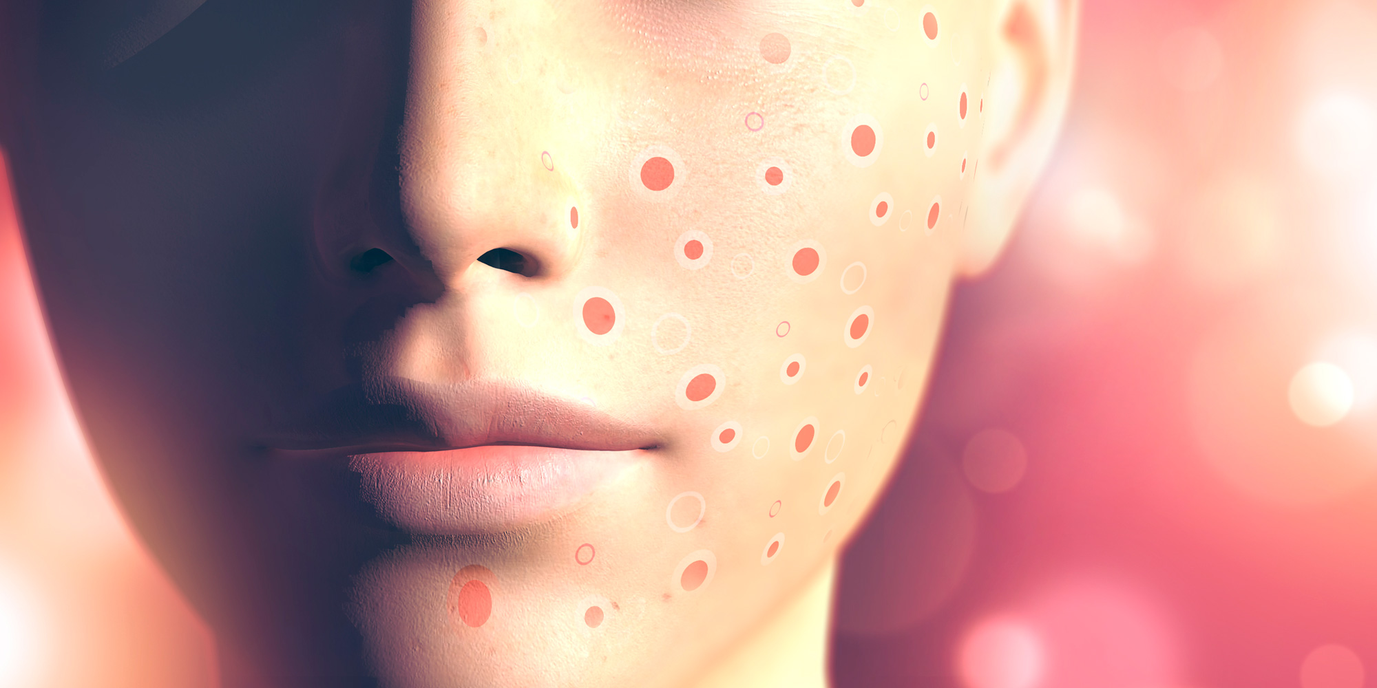 Isotretinoin Am Billigsten