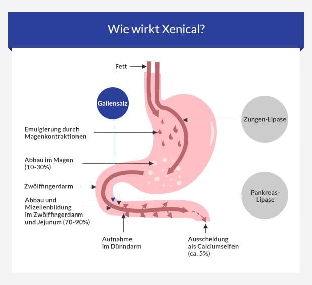 Kaufen xenical