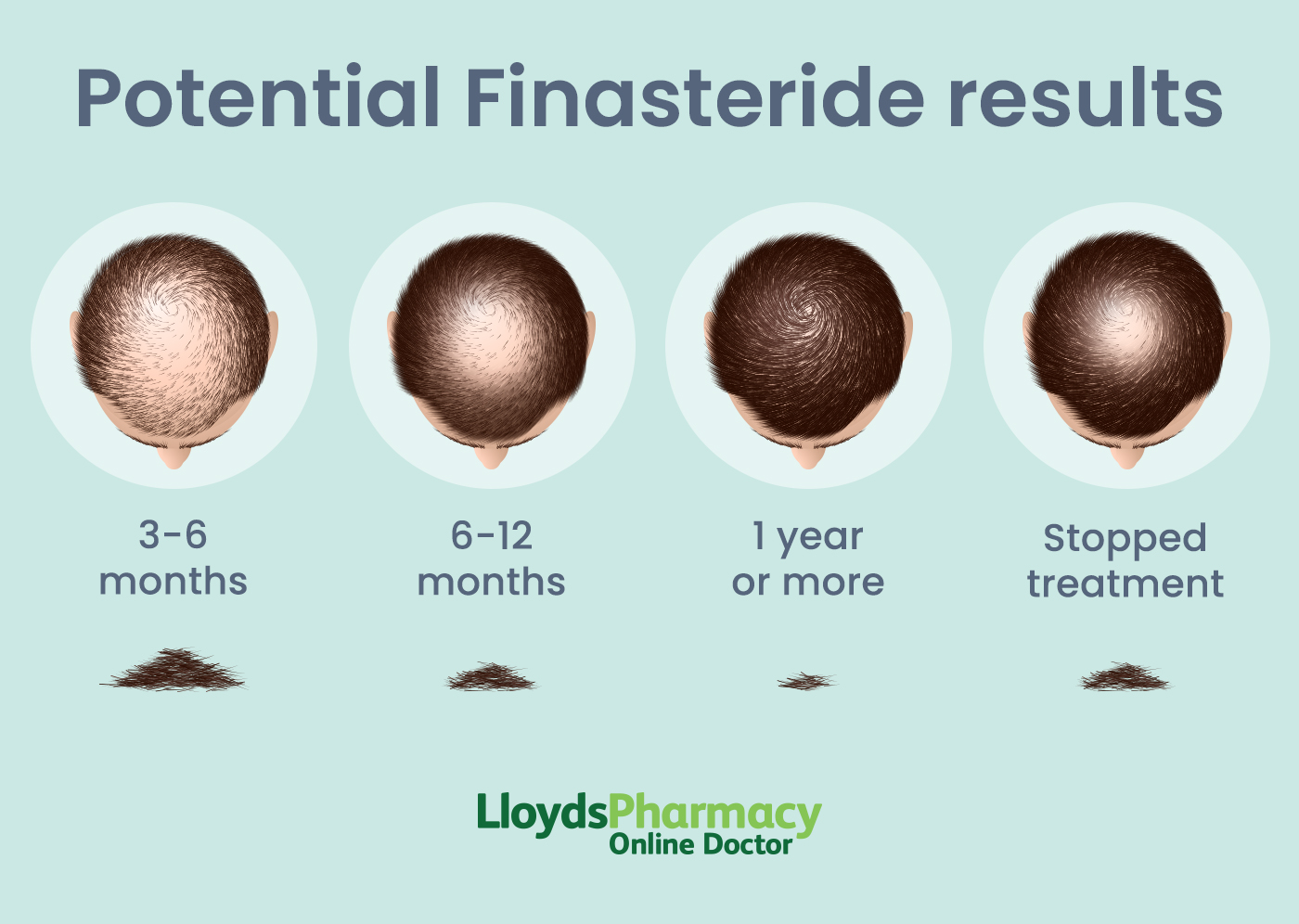 Günstige Finasteride