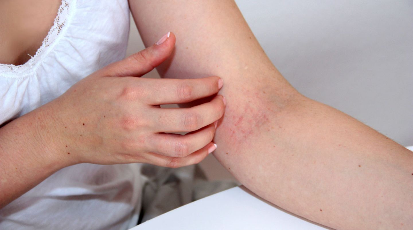 Prednisolon Augentropfen Rezeptfrei