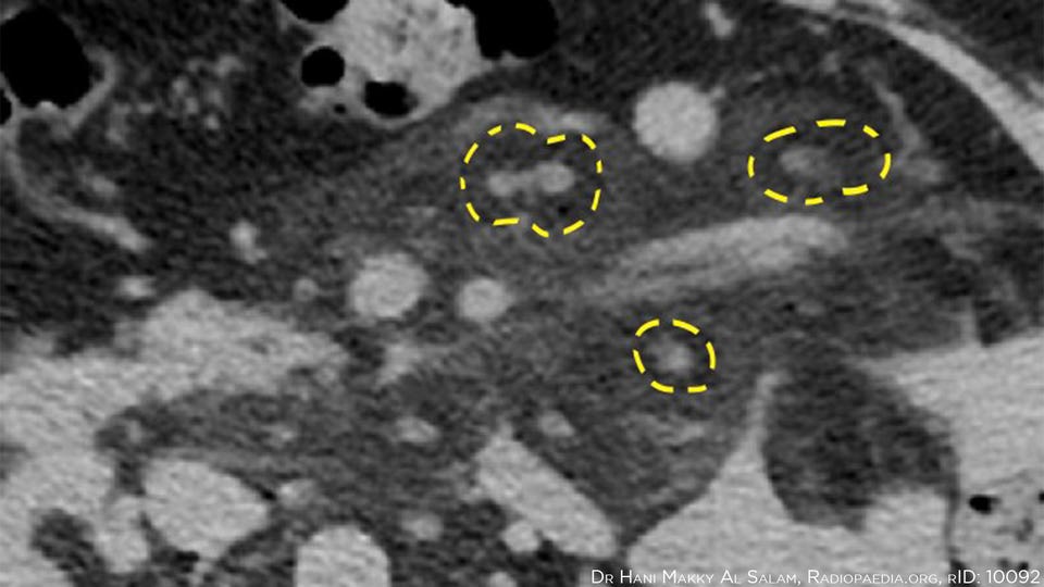 wie man prednisolone kauft