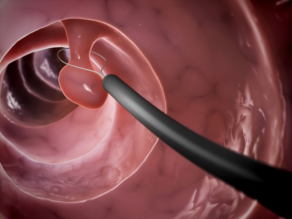 Viagra Kaufen Graz