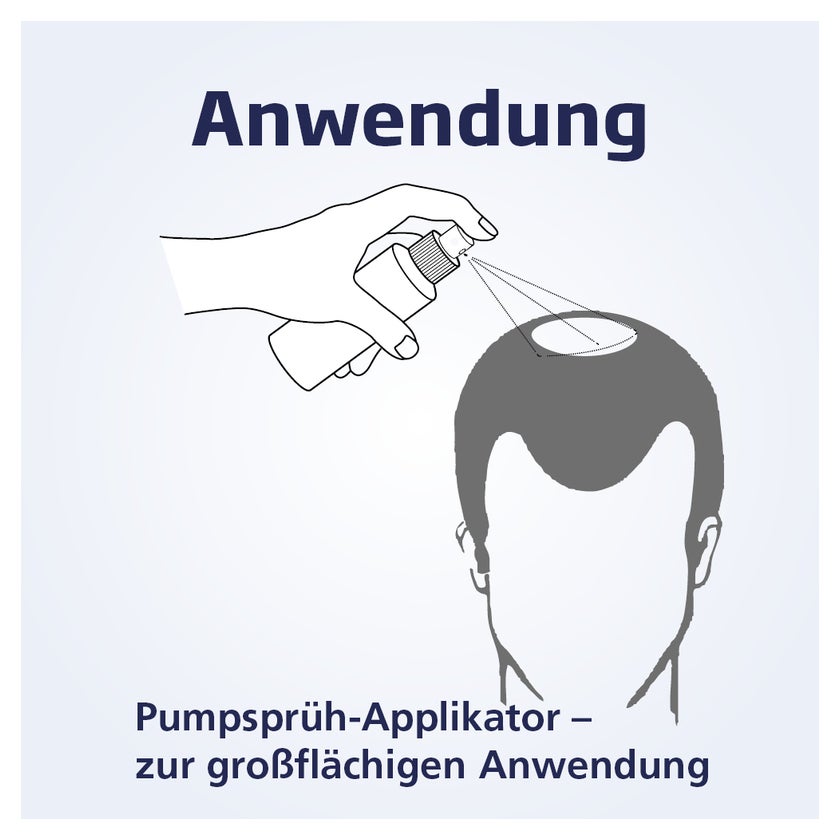 Finasterid 1a pharma 1mg kaufen