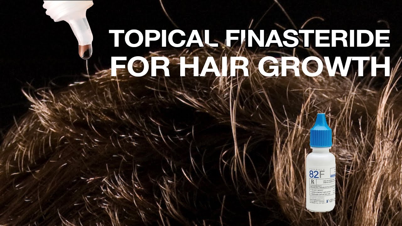 finasteride gel kaufen