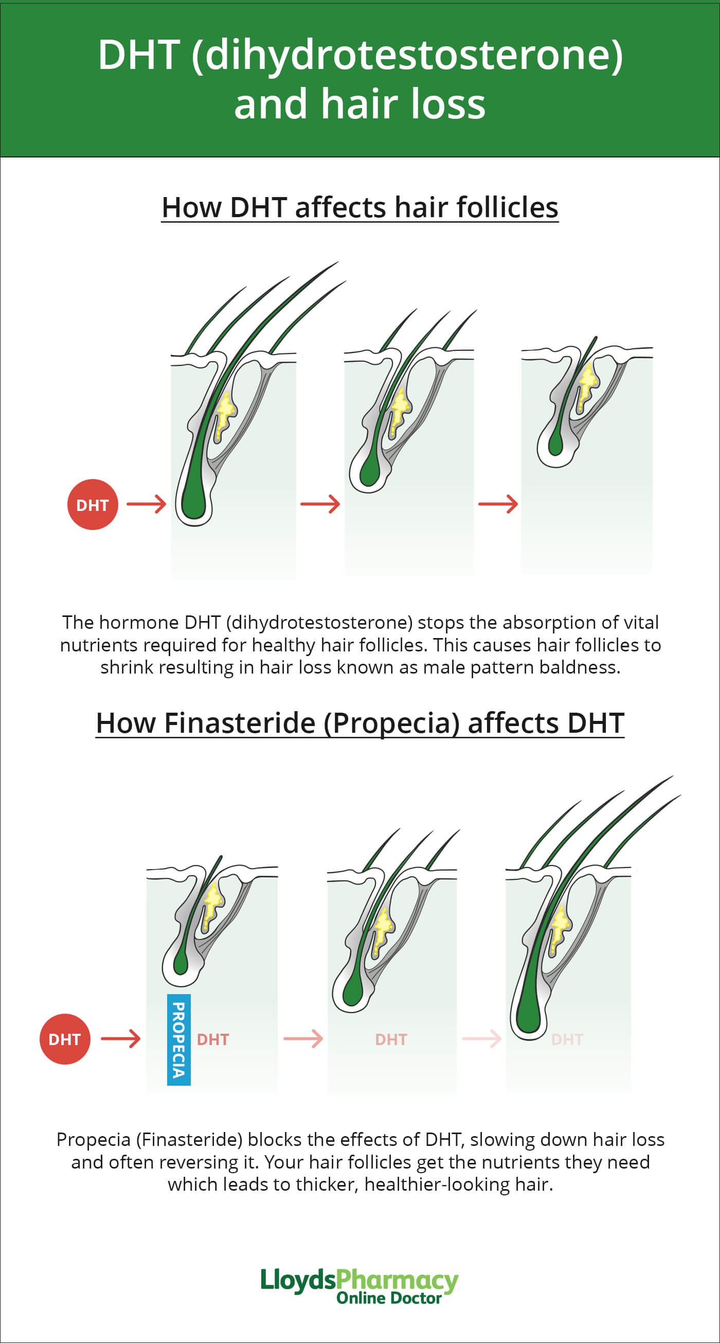 Finasteride Bnf Online