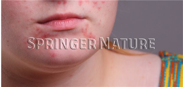 Kosten für roaccutane