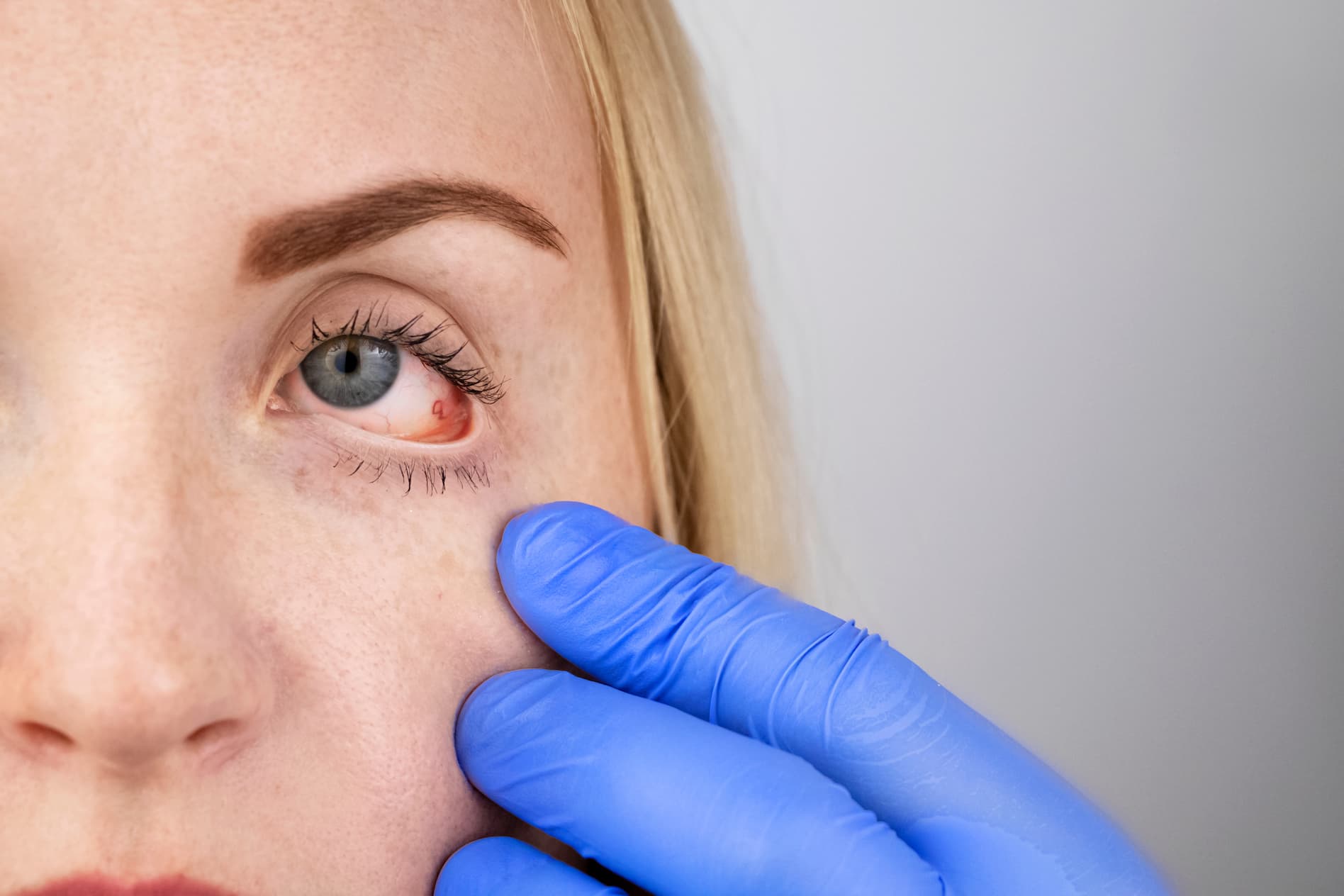 prednisolon in türkei kaufen