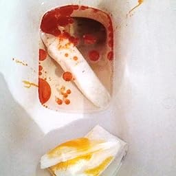Orlistat kaufen schweiz