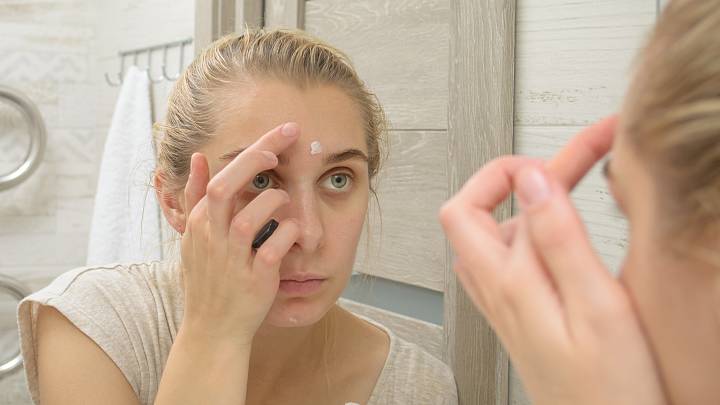 Isotretinoin online apotheke