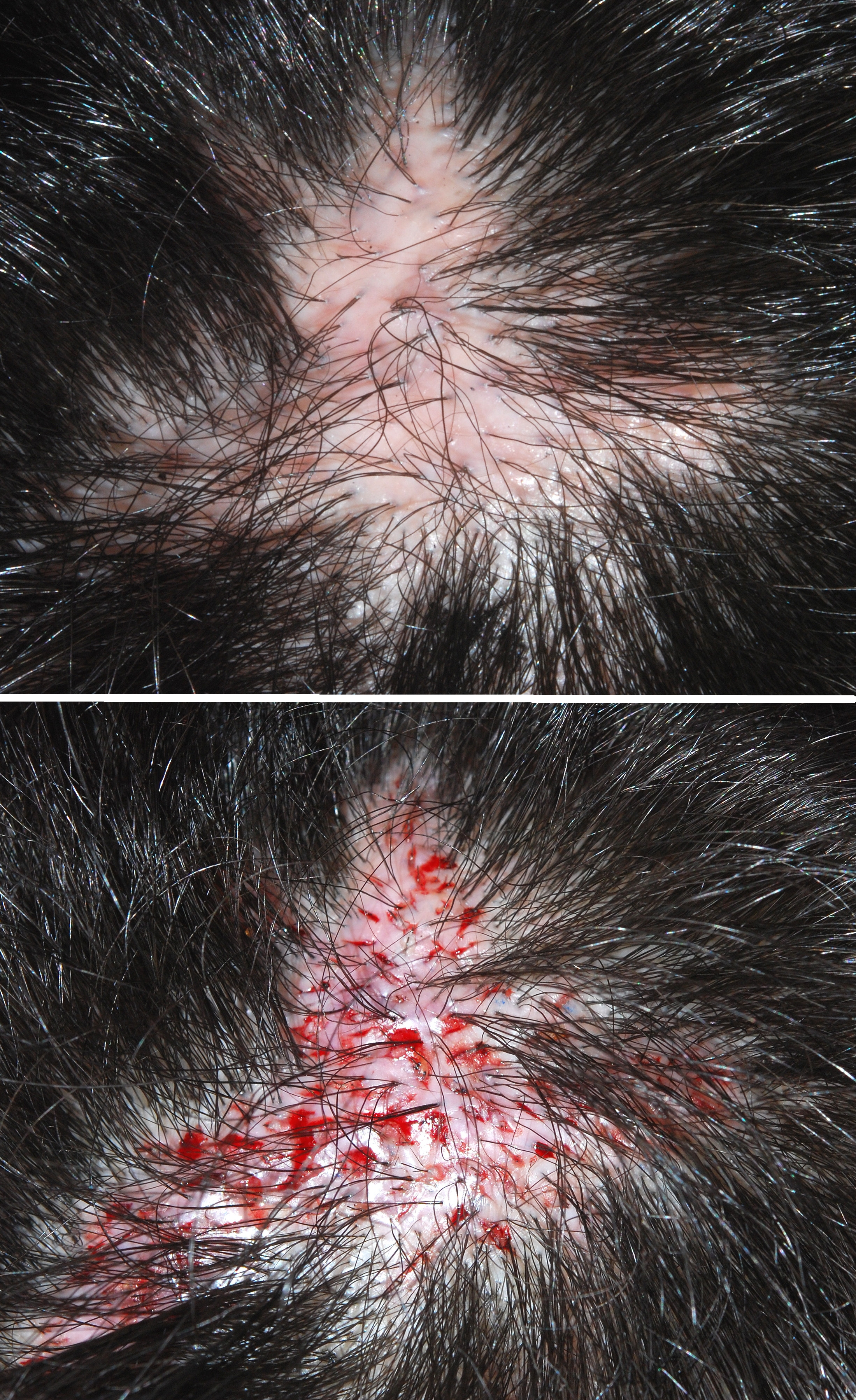 finasteride normon online