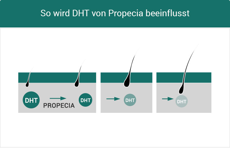 wo propecia kaufen