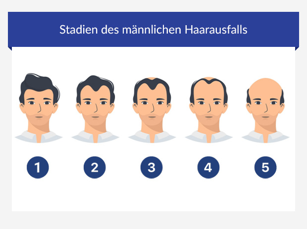 Propecia online schweiz