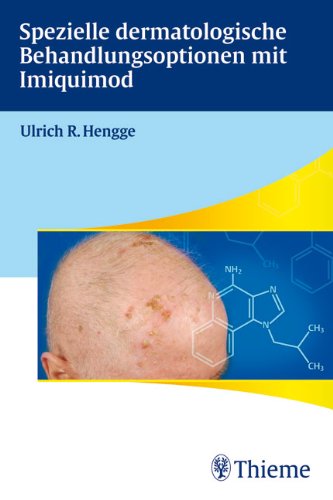 Imiquimod wo zu kaufen