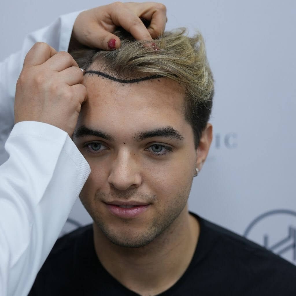Finasteride deutschland