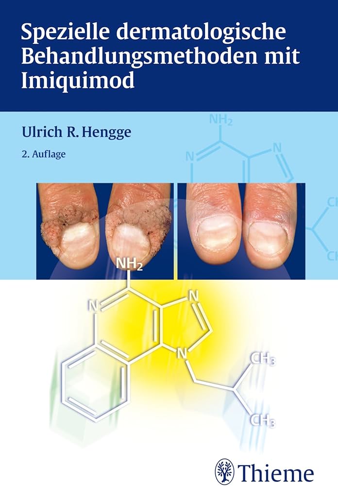 Imiquimod Wie Zu Kaufen