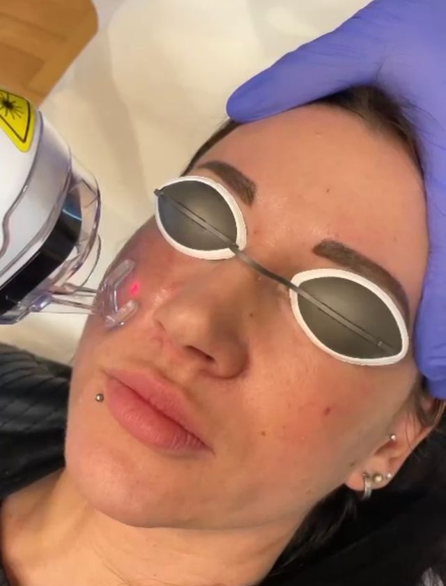 Isotretinoin Billig