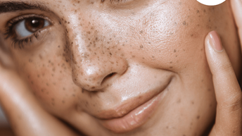 Isotretinoin Tabletten Ohne Rezept