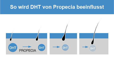 Propecia bestellen