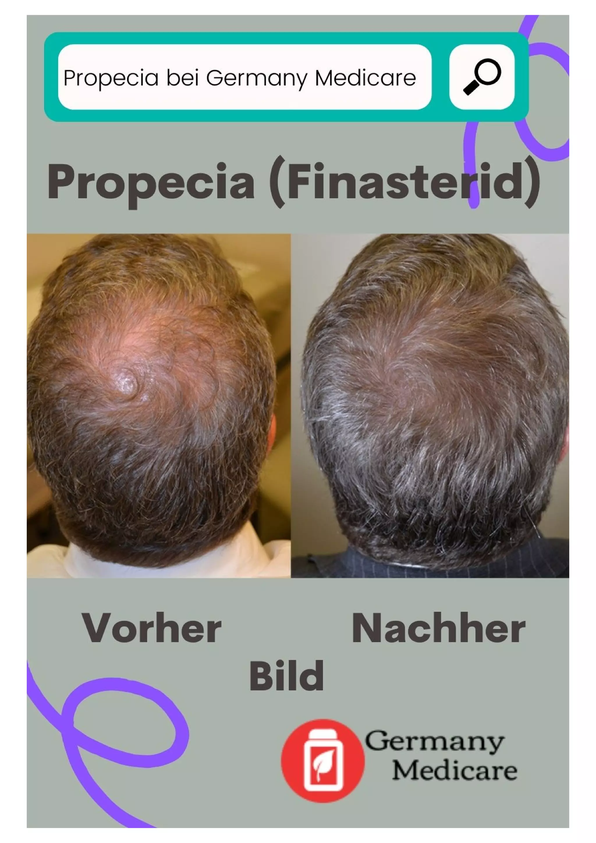 Propecia In Deutschland